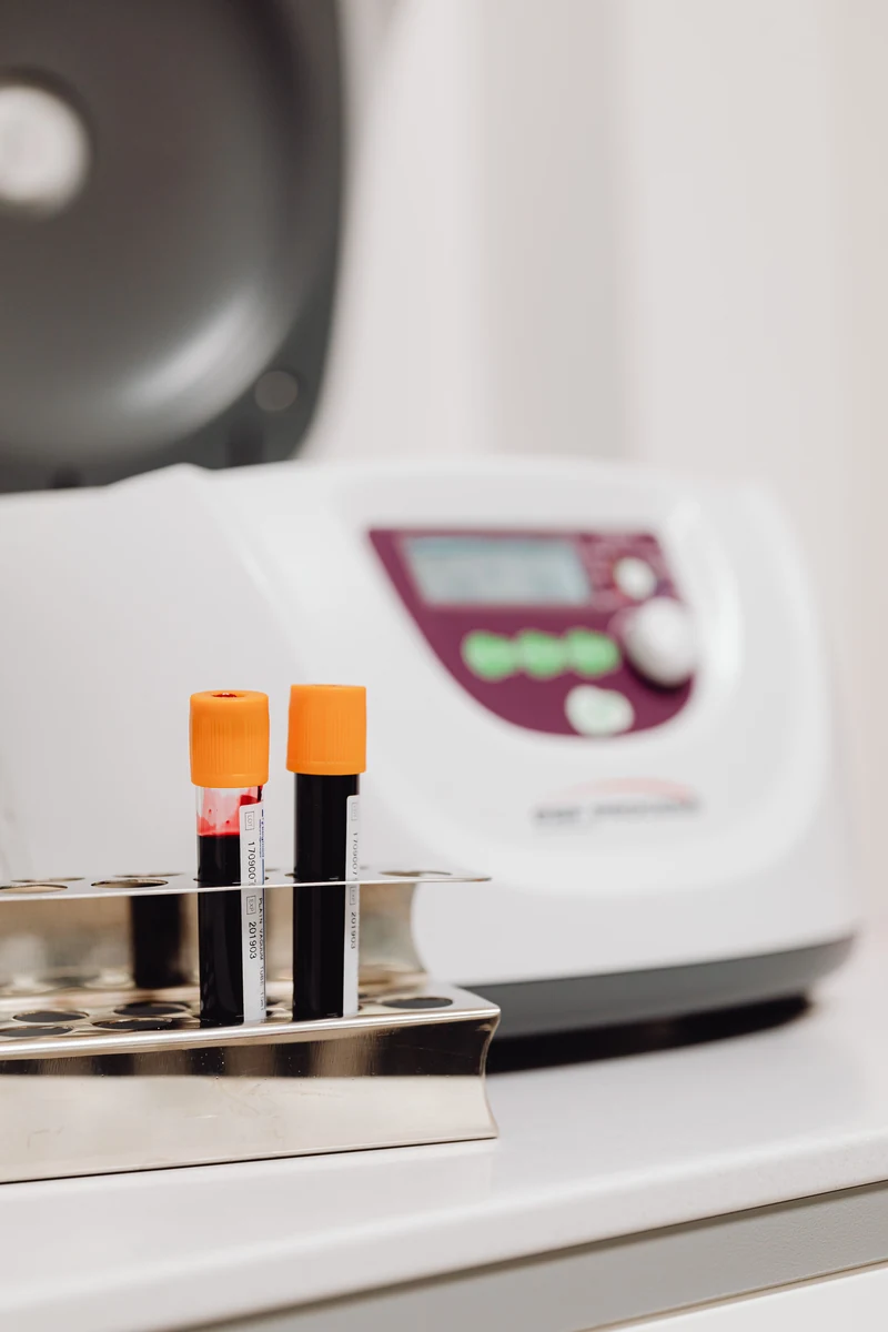 Blood collection tubes in a clean laboratory rack beside testing equipment.